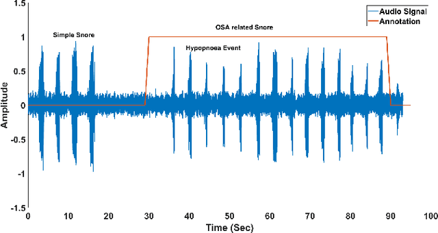 Figure 3 for Automatic Classification of OSA related Snoring Signals from Nocturnal Audio Recordings