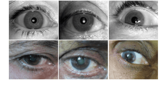 Figure 1 for MTCD: Cataract Detection via Near Infrared Eye Images