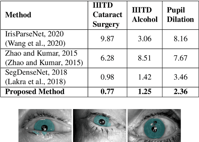 Figure 4 for MTCD: Cataract Detection via Near Infrared Eye Images