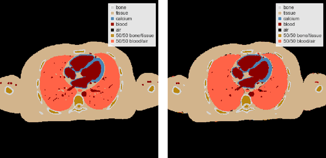 Figure 4 for Learned Spectral Computed Tomography