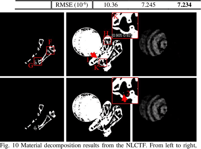 Figure 1 for DLIMD: Dictionary Learning based Image-domain Material Decomposition for spectral CT