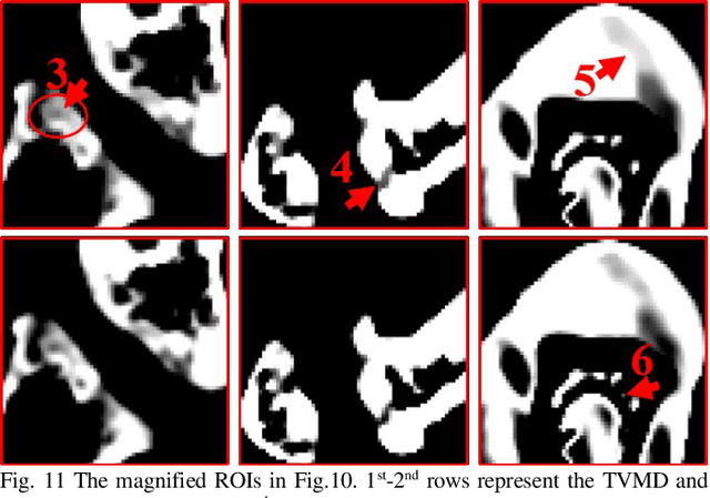 Figure 2 for DLIMD: Dictionary Learning based Image-domain Material Decomposition for spectral CT