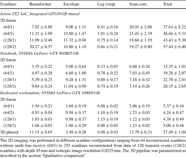 Figure 2 for SUPRA: Open Source Software Defined Ultrasound Processing for Real-Time Applications