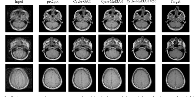 Figure 3 for Unsupervised Adversarial Correction of Rigid MR Motion Artifacts