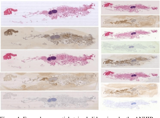 Figure 1 for Accurate and Robust Alignment of Variable-stained Histologic Images Using a General-purpose Greedy Diffeomorphic Registration Tool