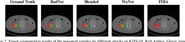 Figure 3 for FIBA: Frequency-Injection based Backdoor Attack in Medical Image Analysis