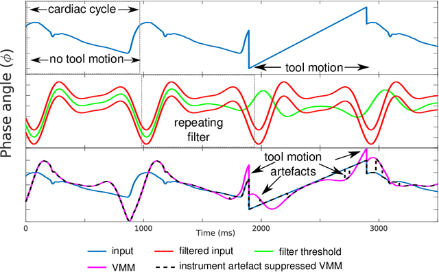 Figure 2 for Surgical Video Motion Magnification with Suppression of Instrument Artefacts