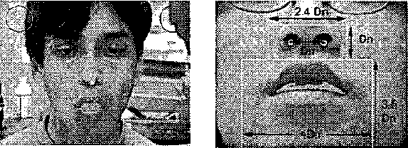 Figure 1 for Facial gesture interfaces for expression and communication