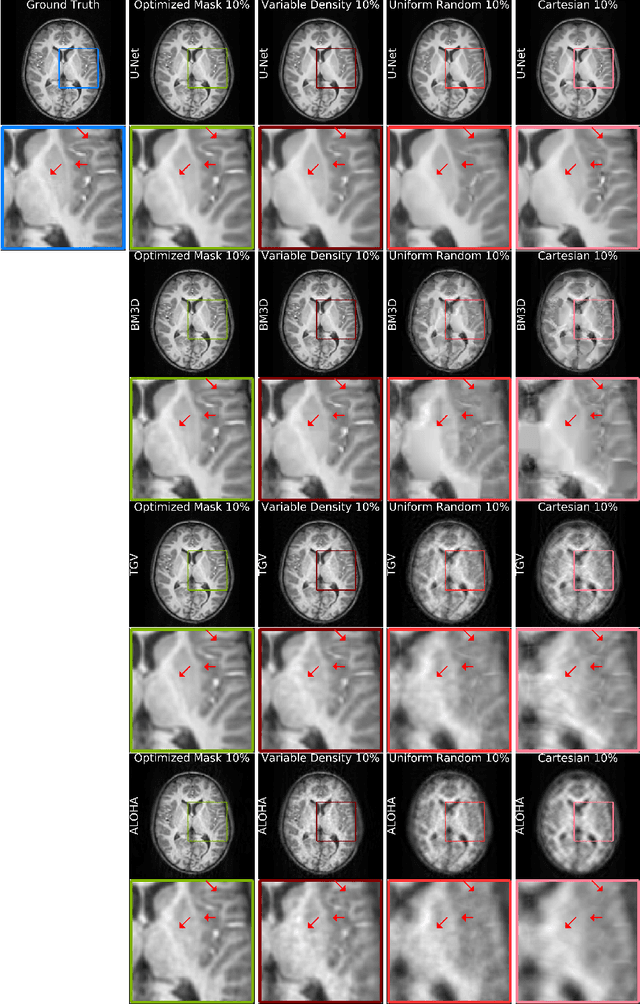 Figure 4 for Learning-based Optimization of the Under-sampling Pattern in MRI