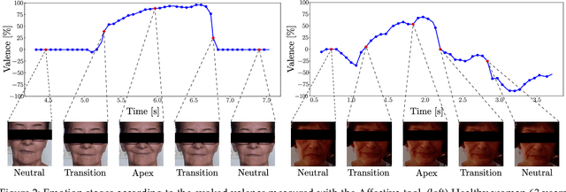 Figure 4 for Exploring Facial Expressions and Affective Domains for Parkinson Detection