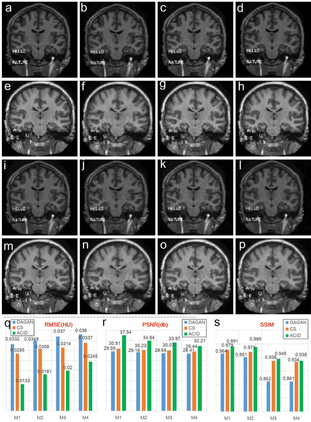 Figure 4 for Stabilizing Deep Tomographic Reconstruction Networks