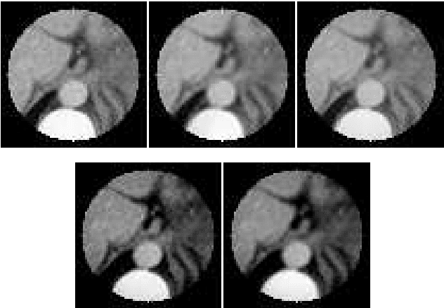 Figure 3 for Spatially-Adaptive Reconstruction in Computed Tomography Based on Statistical Learning