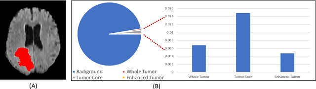 Figure 1 for Offset Curves Loss for Imbalanced Problem in Medical Segmentation