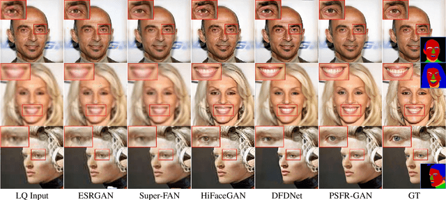 Figure 4 for Progressive Semantic-Aware Style Transformation for Blind Face Restoration
