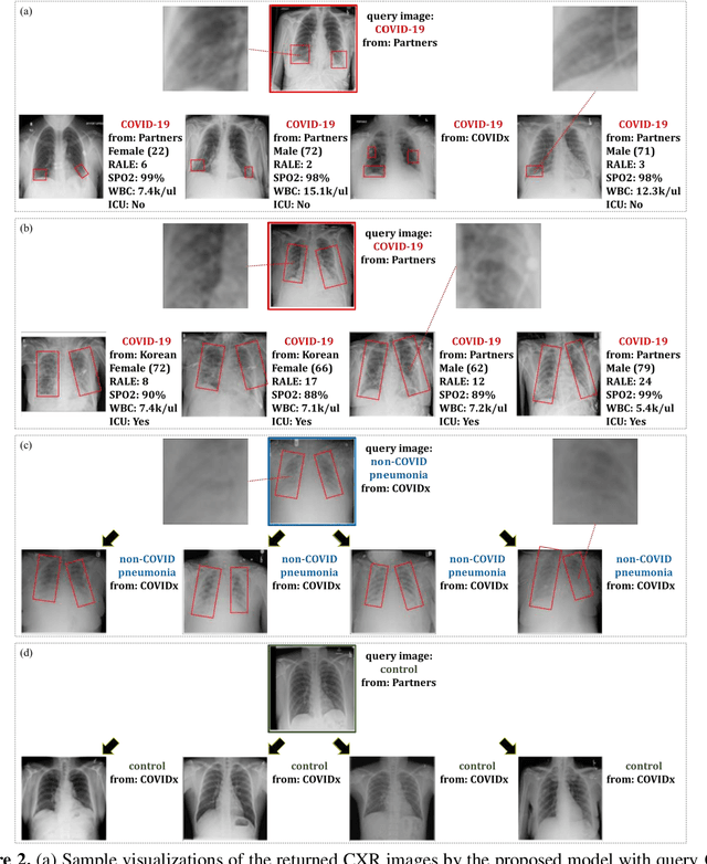 Figure 4 for Deep Metric Learning-based Image Retrieval System for Chest Radiograph and its Clinical Applications in COVID-19