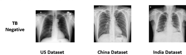 Figure 3 for Mitigating domain shift in AI-based tuberculosis screening with unsupervised domain adaptation