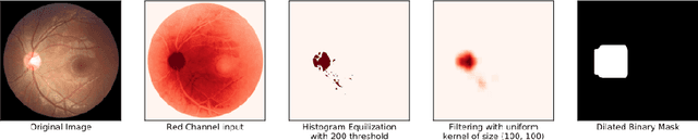 Figure 4 for Enhanced Optic Disk and Cup Segmentation with Glaucoma Screening from Fundus Images using Position encoded CNNs