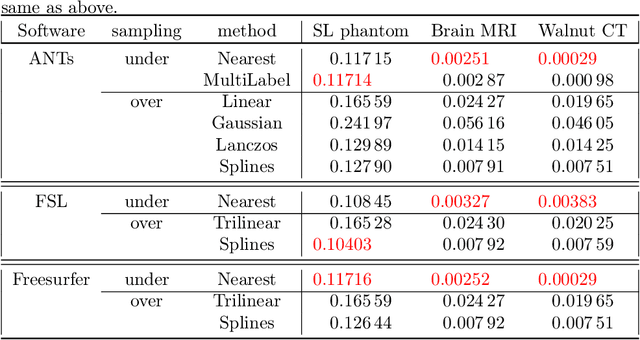 Figure 2 for Oversampling errors in multimodal medical imaging are due to the Gibbs effect