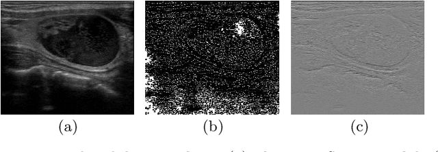 Figure 3 for Knowledge-Driven Learning via Experts Consult for Thyroid Nodule Classification