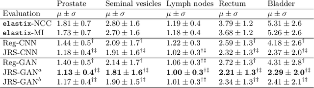 Figure 2 for Adversarial optimization for joint registration and segmentation in prostate CT radiotherapy
