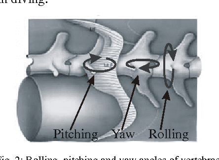 Figure 2 for Design of a Spherical Wrist with Parallel Architecture: Application to Vertebrae of an Eel Robot