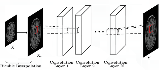 Figure 1 for Deep MR Brain Image Super-Resolution Using Spatio-Structural Priors