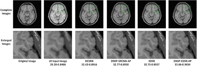 Figure 3 for Deep MR Brain Image Super-Resolution Using Spatio-Structural Priors
