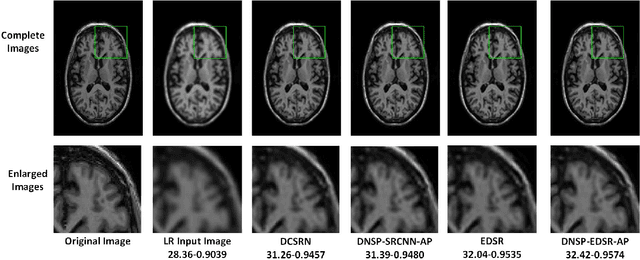 Figure 4 for Deep MR Brain Image Super-Resolution Using Spatio-Structural Priors