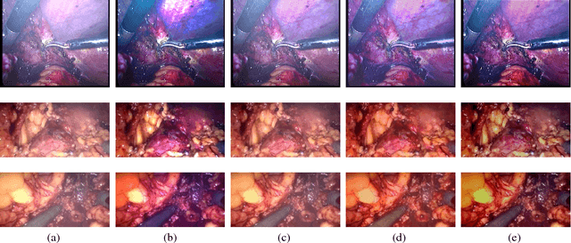 Figure 2 for A Smoke Removal Method for Laparoscopic Images