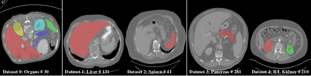 Figure 1 for Learning Incrementally to Segment Multiple Organs in a CT Image