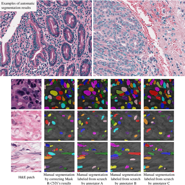 Figure 2 for Dataset of Segmented Nuclei in Hematoxylin and Eosin Stained Histopathology Images of 10 Cancer Types