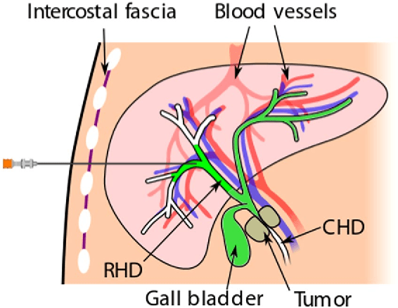 Figure 1 for Evaluation of Direct Haptic 4D Volume Rendering of Partially Segmented Data for Liver Puncture Simulation