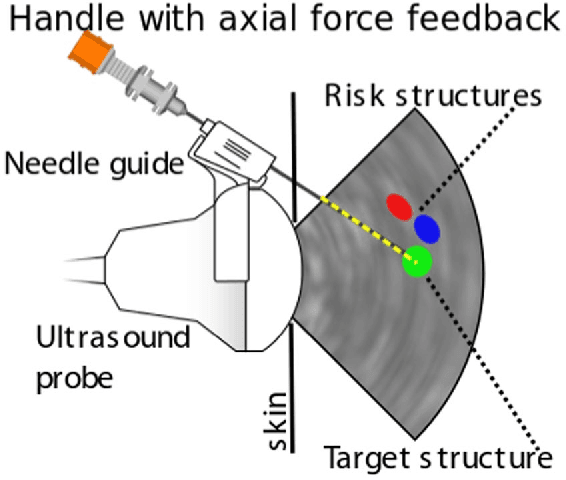 Figure 3 for Evaluation of Direct Haptic 4D Volume Rendering of Partially Segmented Data for Liver Puncture Simulation