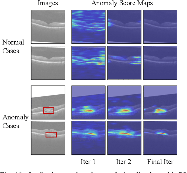 Figure 2 for Self-Supervised Masking for Unsupervised Anomaly Detection and Localization