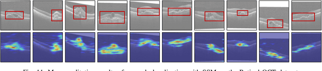 Figure 3 for Self-Supervised Masking for Unsupervised Anomaly Detection and Localization