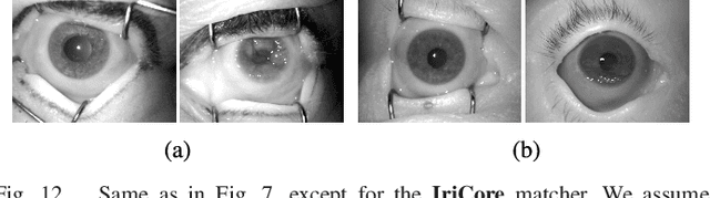 Figure 4 for Iris Recognition After Death