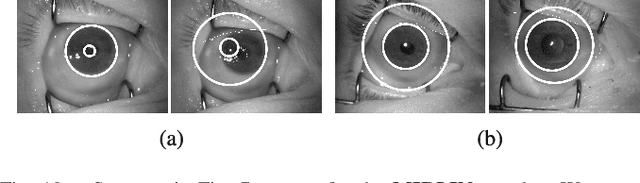 Figure 2 for Iris Recognition After Death