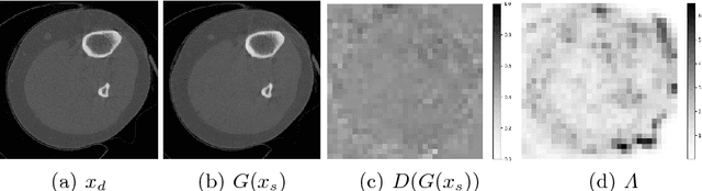 Figure 4 for Adversarial Sparse-View CBCT Artifact Reduction