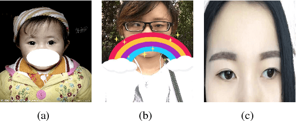 Figure 1 for Automated Strabismus Detection based on Deep neural networks for Telemedicine Applications