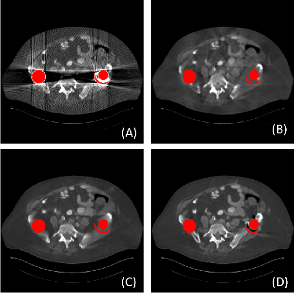 Figure 1 for IDOL-Net: An Interactive Dual-Domain Parallel Network for CT Metal Artifact Reduction