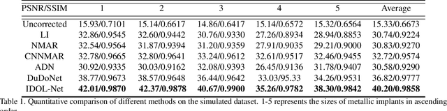 Figure 2 for IDOL-Net: An Interactive Dual-Domain Parallel Network for CT Metal Artifact Reduction