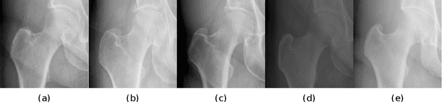 Figure 2 for Contour Transformer Network for One-shot Segmentation of Anatomical Structures