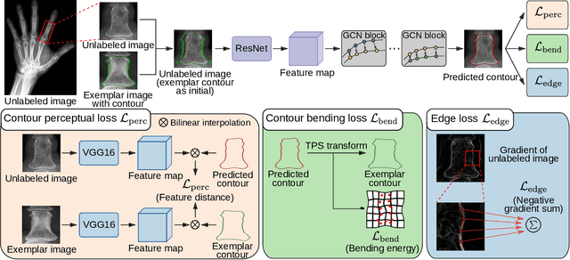 Figure 3 for Contour Transformer Network for One-shot Segmentation of Anatomical Structures