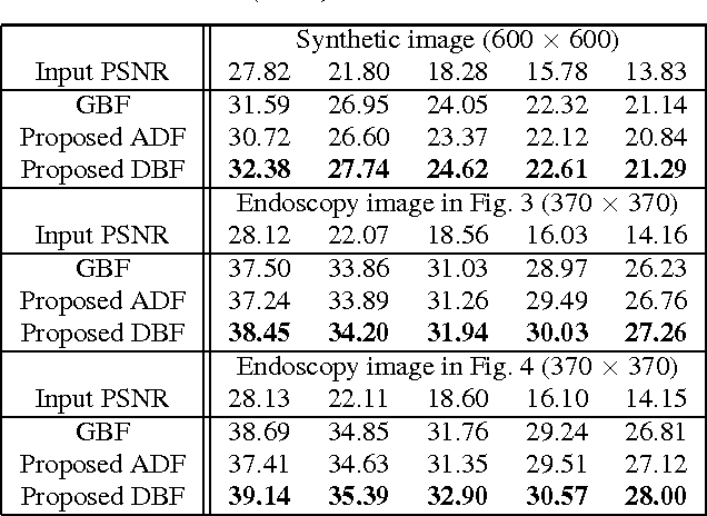 Figure 2 for Directional Bilateral Filters