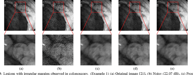 Figure 4 for Directional Bilateral Filters