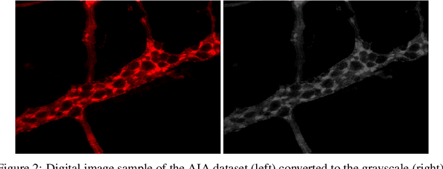 Figure 3 for Automatic Chronic Degenerative Diseases Identification Using Enteric Nervous System Images