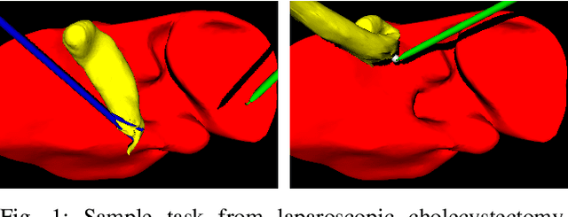 Figure 1 for Cooperative Assistance in Robotic Surgery through Multi-Agent Reinforcement Learning