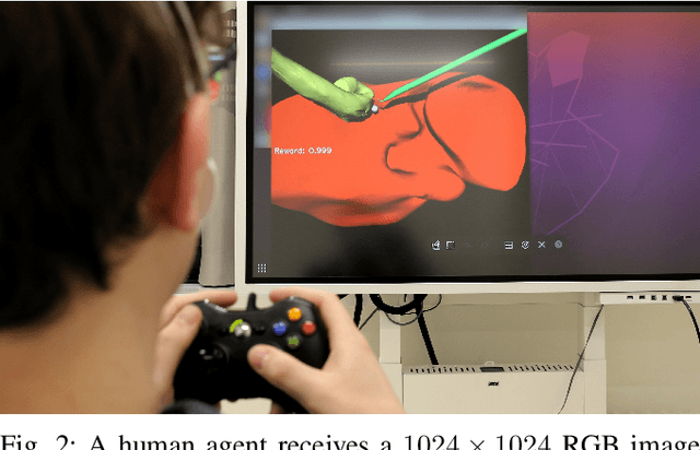 Figure 2 for Cooperative Assistance in Robotic Surgery through Multi-Agent Reinforcement Learning