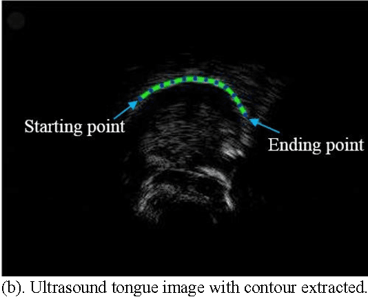 Figure 1 for Contour-based 3d tongue motion visualization using ultrasound image sequences