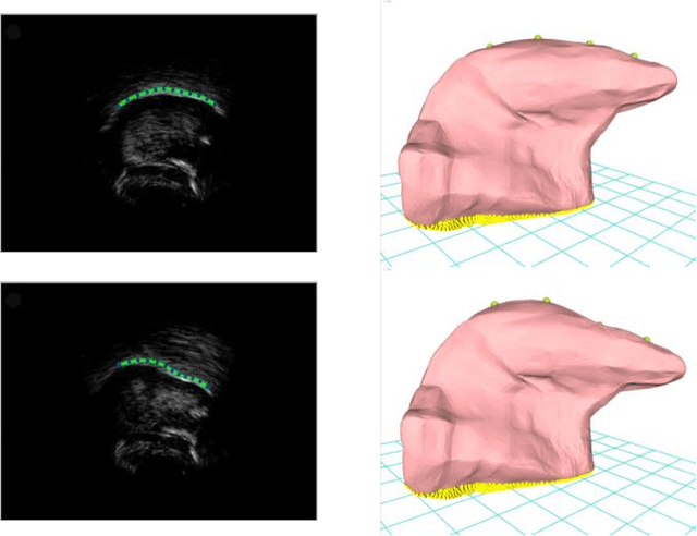 Figure 3 for Contour-based 3d tongue motion visualization using ultrasound image sequences